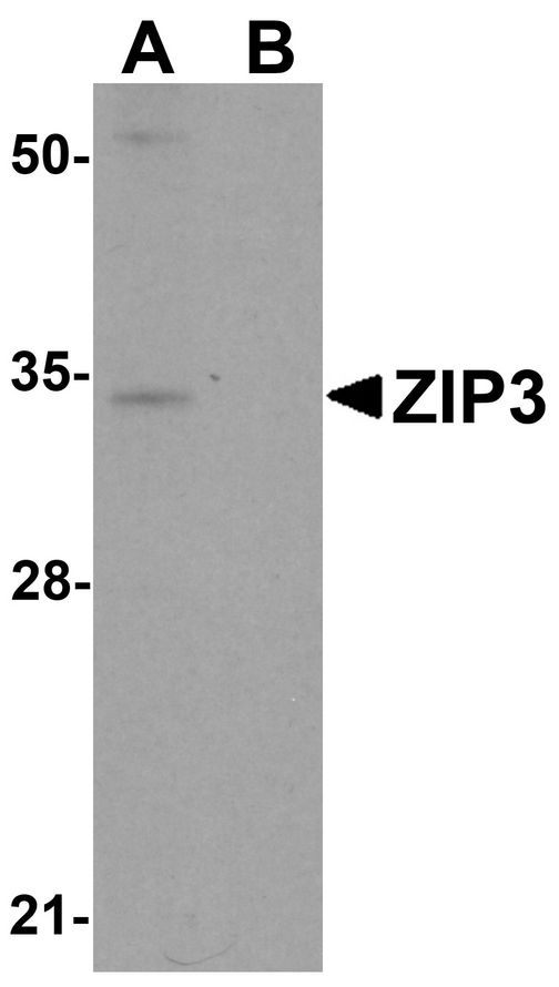 SLC39A3 / ZIP3 Antibody - Western blot analysis of ZIP3 in mouse lung tissue lysate with ZIP3 antibody at 1 ug/ml in (A) the absence and (B) the presence of blocking peptide.