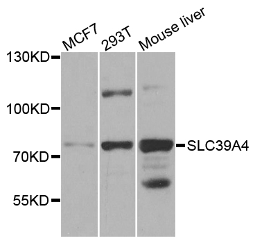 SLC39A4 / ZIP4 Antibody - Western blot analysis of extracts of various cell lines.