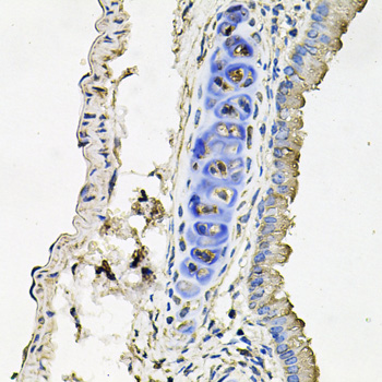 SLC39A4 / ZIP4 Antibody - Immunohistochemistry of paraffin-embedded mouse lung tissue.