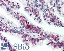 SLC39A6 / LIV-1 Antibody - Anti-SLC39A6 antibody IHC of human prostate. Immunohistochemistry of formalin-fixed, paraffin-embedded tissue after heat-induced antigen retrieval.