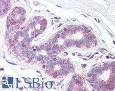 SLC39A6 / LIV-1 Antibody - Anti-SLC39A6 antibody IHC of human breast. Immunohistochemistry of formalin-fixed, paraffin-embedded tissue after heat-induced antigen retrieval.
