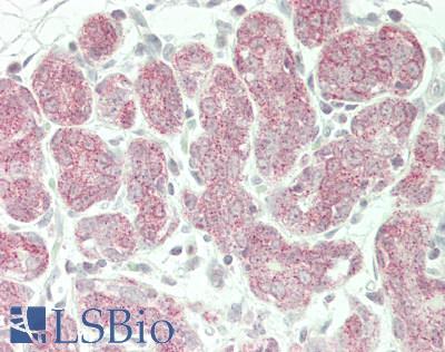 SLC39A7 / ZIP7 Antibody - Human Breast: Formalin-Fixed, Paraffin-Embedded (FFPE)