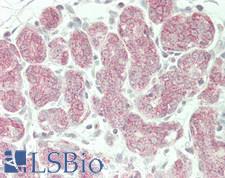 SLC39A7 / ZIP7 Antibody - Human Breast: Formalin-Fixed, Paraffin-Embedded (FFPE)