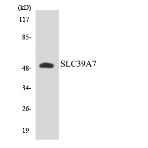 SLC39A7 / ZIP7 Antibody - Western blot analysis of the lysates from HUVECcells using SLC39A7 antibody.