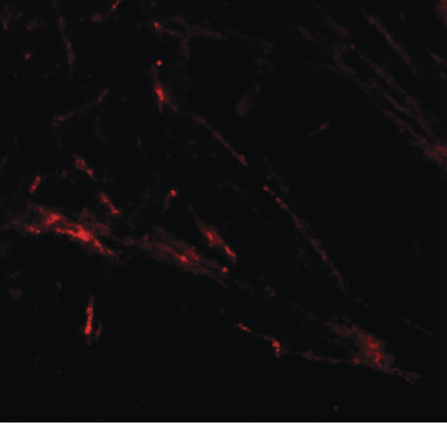 SLC39A7 / ZIP7 Antibody - Immunofluorescence of ZIP7 in human brain tissue with ZIP7 antibody at 20 ug/ml.