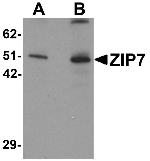 SLC39A7 / ZIP7 Antibody - Western blot analysis of ZIP7 in mouse brain tissue lysate with ZIP7 antibody at (A) 0.5 and (B) 1 ug/ml.