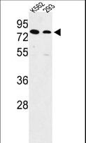 SLC3A1 / ATR1 Antibody - Western blot of SLC3A1 Antibody in K562, 293 cell line lysates (35 ug/lane). SLC3A1 (arrow) was detected using the purified antibody.