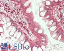 SLC3A1 / ATR1 Antibody - Human Small Intestine: Formalin-Fixed, Paraffin-Embedded (FFPE)