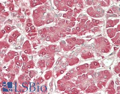 SLC3A1 / ATR1 Antibody - Human Pancreas: Formalin-Fixed, Paraffin-Embedded (FFPE)
