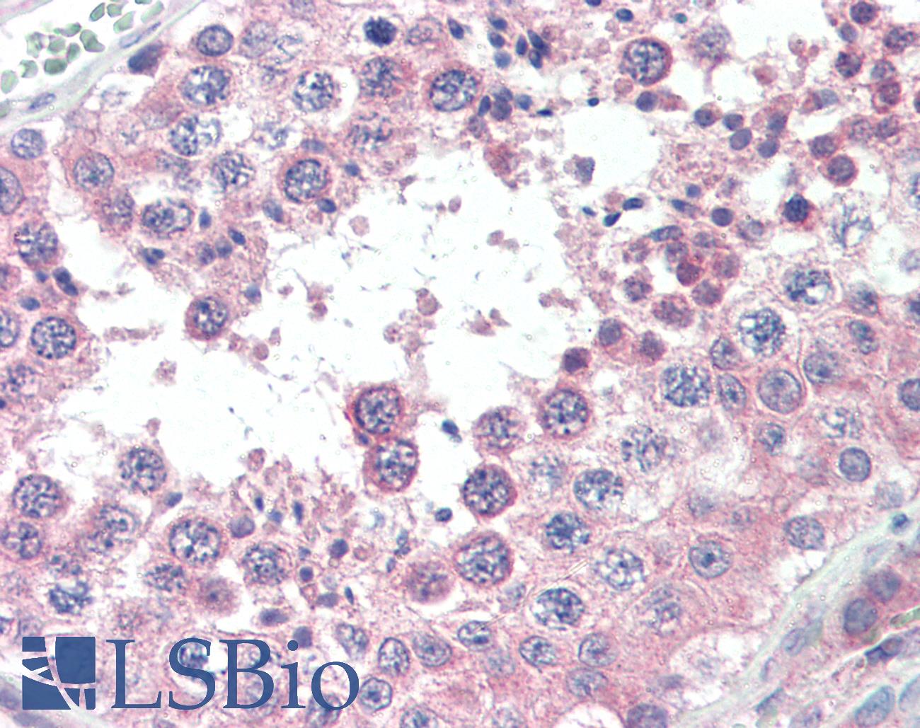 SLC3A2 / CD98 Heavy Chain Antibody - Anti-SLC3A2 antibody IHC of human, testis. Immunohistochemistry of formalin-fixed, paraffin-embedded tissue after heat-induced antigen retrieval. Antibody concentration 15 ug/ml.  This image was taken for the unconjugated form of this product. Other forms have not been tested.
