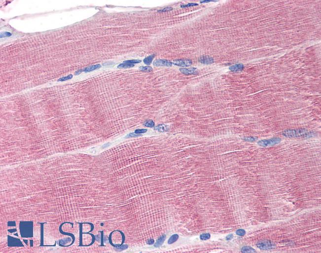 SLC40A1 / Ferroportin-1 Antibody - Anti-SLC40A1 antibody IHC of human skeletal muscle. Immunohistochemistry of formalin-fixed, paraffin-embedded tissue after heat-induced antigen retrieval. Antibody concentration 20 ug/ml.