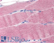 SLC40A1 / Ferroportin-1 Antibody - Anti-SLC40A1 antibody IHC of human skeletal muscle. Immunohistochemistry of formalin-fixed, paraffin-embedded tissue after heat-induced antigen retrieval. Antibody concentration 20 ug/ml.