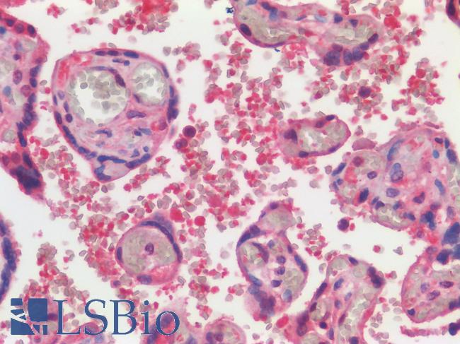 SLC40A1 / Ferroportin-1 Antibody - Human Placenta Erythrocytes: Formalin-Fixed, Paraffin-Embedded (FFPE)