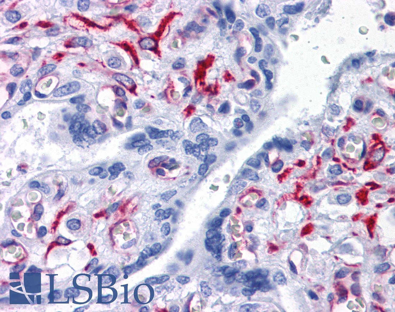 SLC44A2 / CTL2 Antibody - Anti-SLC44A2 antibody IHC of human placenta. Immunohistochemistry of formalin-fixed, paraffin-embedded tissue after heat-induced antigen retrieval. Antibody concentration 10 ug/ml.