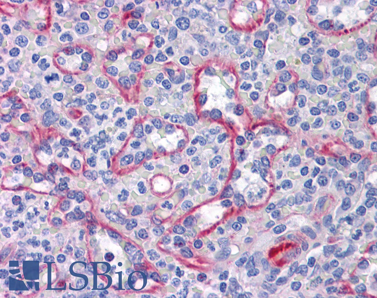SLC44A2 / CTL2 Antibody - Anti-SLC44A2 antibody IHC of human spleen. Immunohistochemistry of formalin-fixed, paraffin-embedded tissue after heat-induced antigen retrieval. Antibody concentration 10 ug/ml.