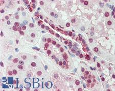 SLC44A2 / CTL2 Antibody - Anti-SLC44A2 antibody IHC of human kidney. Immunohistochemistry of formalin-fixed, paraffin-embedded tissue after heat-induced antigen retrieval.
