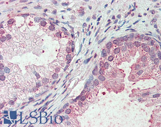 SLC44A2 / CTL2 Antibody - Anti-SLC44A2 antibody IHC of human prostate. Immunohistochemistry of formalin-fixed, paraffin-embedded tissue after heat-induced antigen retrieval.