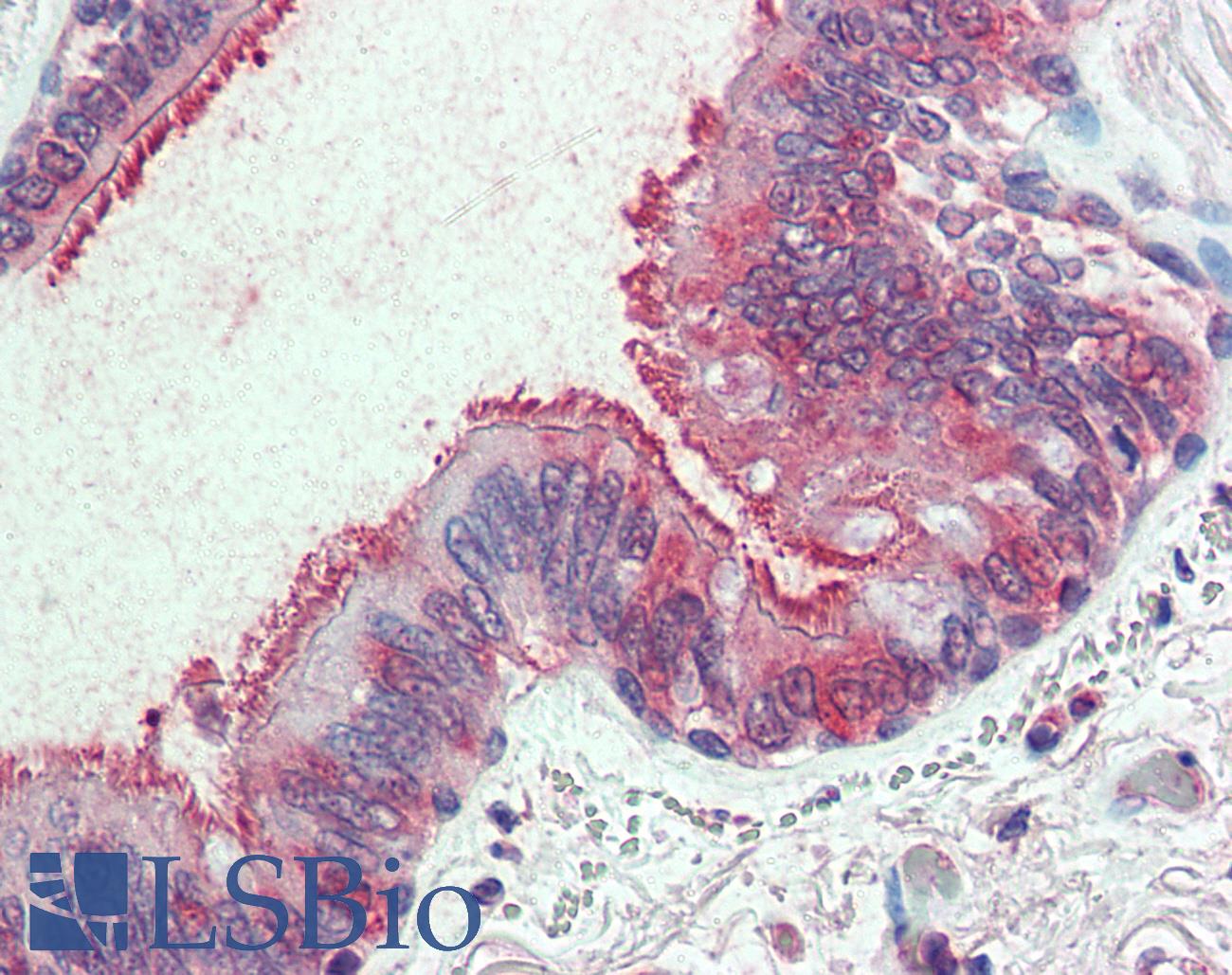 SLC44A2 / CTL2 Antibody - Anti-SLC44A2 antibody IHC of human lung, respiratory epithelium. Immunohistochemistry of formalin-fixed, paraffin-embedded tissue after heat-induced antigen retrieval.