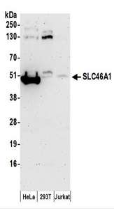 SLC46A1 / HCP1 Antibody - Detection of Human SLC46A1 by Western Blot. Samples: Whole cell lysate (50 ug) prepared using NETN buffer from HeLa, 293T, and Jurkat cells. Antibodies: Affinity purified rabbit anti-SLC46A1 antibody used for WB at 0.1 ug/ml. Detection: Chemiluminescence with an exposure time of 3 minutes.