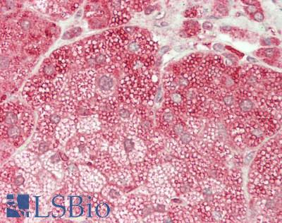 SLC46A1 / HCP1 Antibody - Human Adrenal: Formalin-Fixed, Paraffin-Embedded (FFPE)