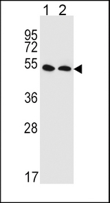 SLC47A1 / MATE1 Antibody - SLC47A1 Antibody western blot of HepG2(lane 1),MDA-MB435(lane 2) cell line lysates (35 ug/lane). The SLC47A1 antibody detected the SLC47A1 protein (arrow).