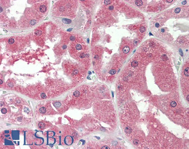 SLC47A2 Antibody - Human, Kidney: Formalin-Fixed Paraffin-Embedded (FFPE)