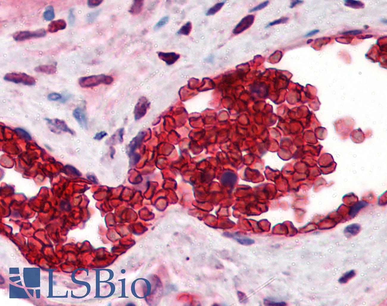 SLC4A1 / Band 3 / AE1 Antibody - Anti-Band 3 antibody IHC of human placenta, erythrocytes. Immunohistochemistry of formalin-fixed, paraffin-embedded tissue after heat-induced antigen retrieval. Antibody concentration 10 ug/ml.