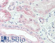 SLC4A11 / NABC1 Antibody - Anti-SLC4A11 / NABC1 antibody IHC staining of human kidney. Immunohistochemistry of formalin-fixed, paraffin-embedded tissue after heat-induced antigen retrieval.