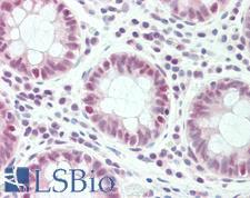 SLC4A1AP / Kanadaptin Antibody - Anti-SLC4A1AP / Kanadaptin antibody IHC staining of human colon. Immunohistochemistry of formalin-fixed, paraffin-embedded tissue after heat-induced antigen retrieval. Antibody dilution 1:100.