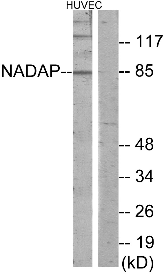 SLC4A1AP / Kanadaptin Antibody - Western blot analysis of lysates from HUVEC cells, using NADAP Antibody. The lane on the right is blocked with the synthesized peptide.