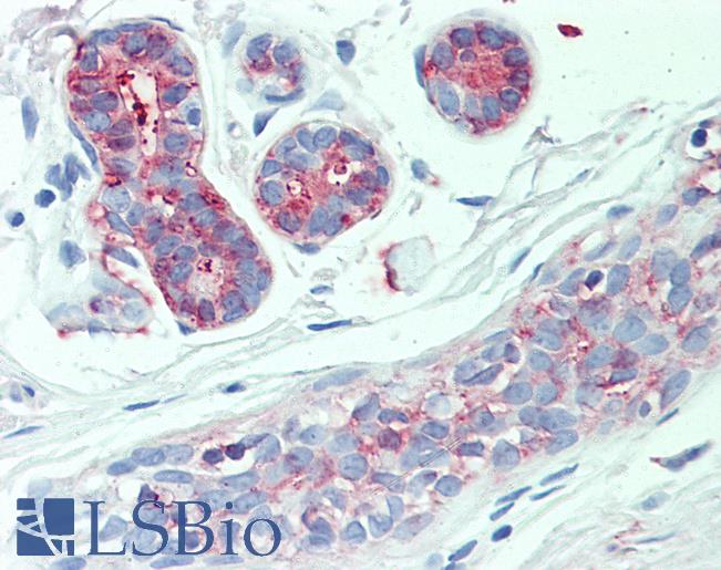 SLC4A2 / AE2 Antibody - Anti-SLC4A2 antibody IHC of human breast. Immunohistochemistry of formalin-fixed, paraffin-embedded tissue after heat-induced antigen retrieval.