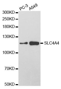 SLC4A4 / NBC1 Antibody - Western blot analysis of extracts of various cell lines, using SLC4A4 antibody.