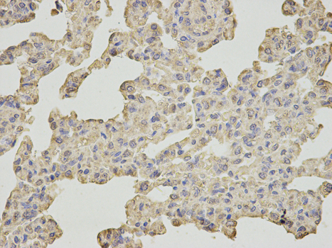 SLC4A4 / NBC1 Antibody - Immunohistochemistry of paraffin-embedded rat lung using SLC4A4 antibody at dilution of 1:200 (400x lens).