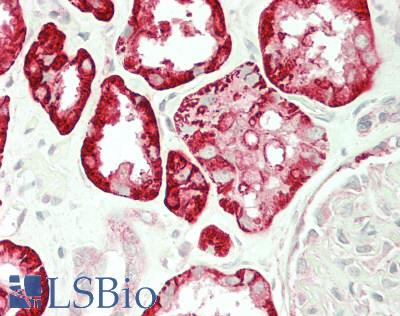SLC4A4 / NBC1 Antibody - Human Kidney: Formalin-Fixed, Paraffin-Embedded (FFPE)