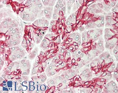 SLC4A4 / NBC1 Antibody - Human Pancreas: Formalin-Fixed, Paraffin-Embedded (FFPE)