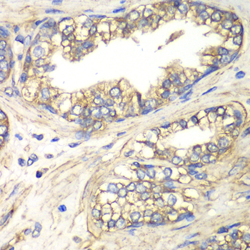 SLC4A4 / NBC1 Antibody - Immunohistochemistry of paraffin-embedded human prostate.