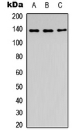 SLC4A7 Antibody - Western blot analysis of SLC4A7 expression in A549 (A); Raw264.7 (B); PC12 (C) whole cell lysates.