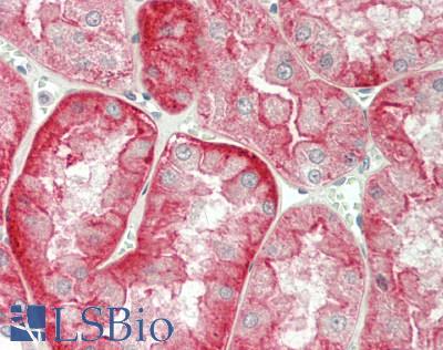 SLC4A7 Antibody - Human Kidney: Formalin-Fixed, Paraffin-Embedded (FFPE)