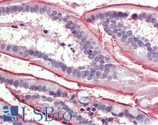 SLC5A1 / SGLT1 Antibody - Anti-SLC5A1 / SGLT1 antibody IHC of human small intestine. Immunohistochemistry of formalin-fixed, paraffin-embedded tissue after heat-induced antigen retrieval. Antibody concentration 3.75 ug/ml.