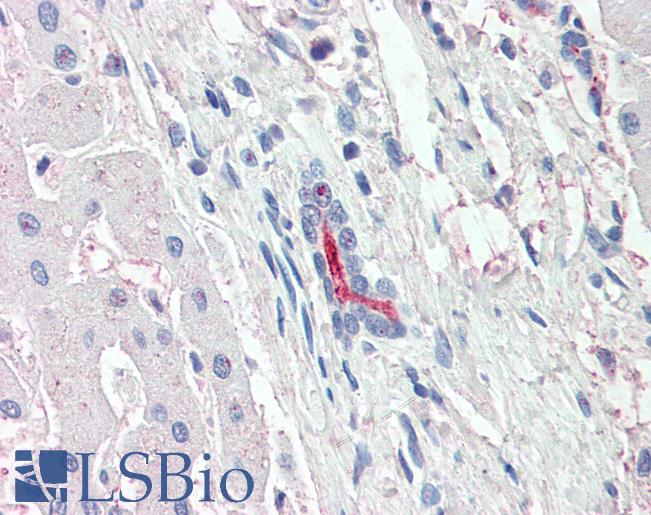 SLC5A1 / SGLT1 Antibody - Anti-SLC5A1 / SGLT1 antibody IHC of human liver. Immunohistochemistry of formalin-fixed, paraffin-embedded tissue after heat-induced antigen retrieval.