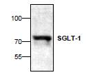 SLC5A1 / SGLT1 Antibody - Western blot of SGLT-1 expression in Jurkat cell lysate