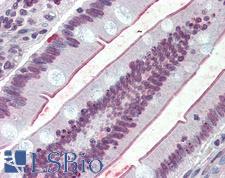 SLC5A1 / SGLT1 Antibody - Anti-SLC5A1 / SGLT1 antibody IHC of human small intestine. Immunohistochemistry of formalin-fixed, paraffin-embedded tissue after heat-induced antigen retrieval.