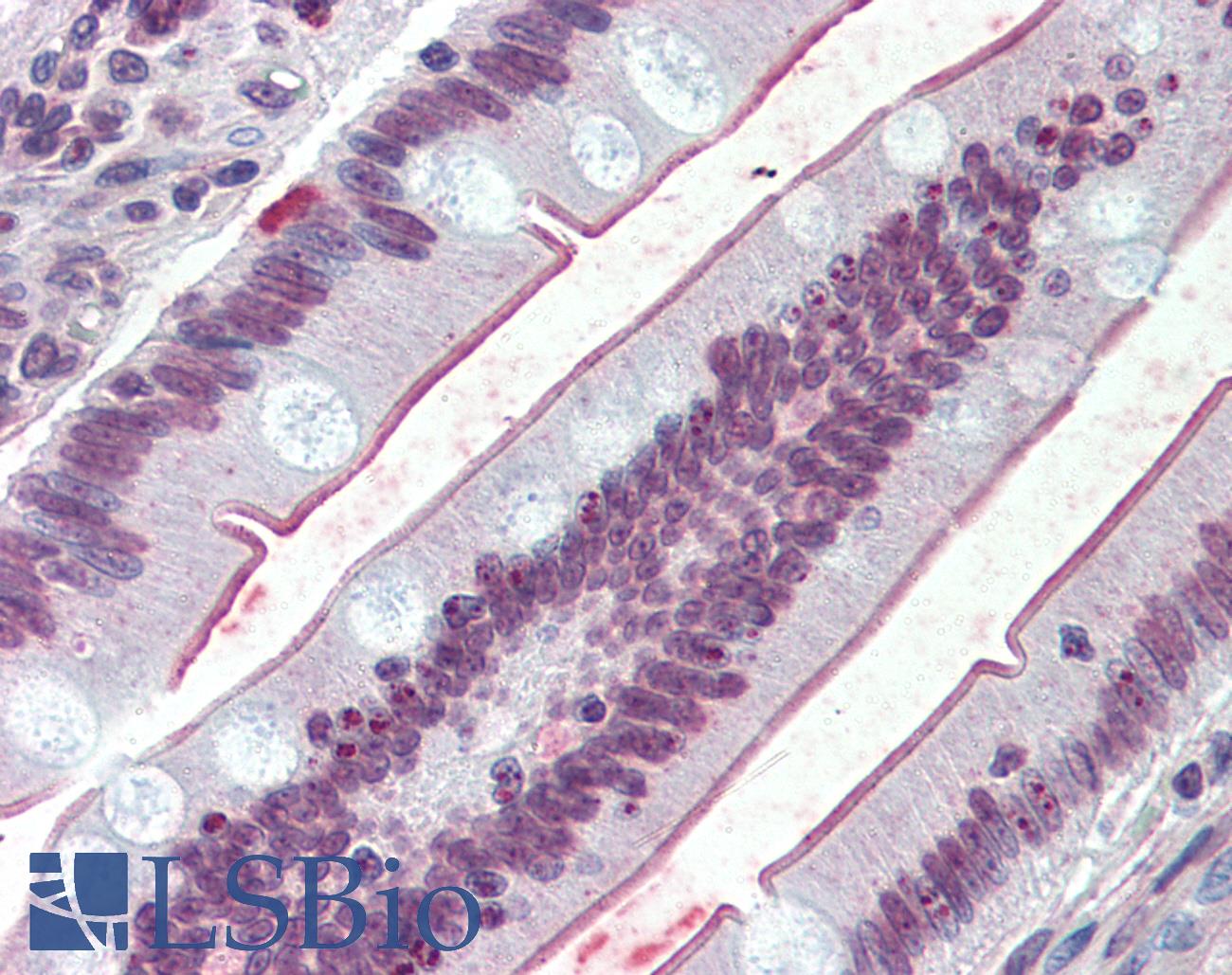 SLC5A1 / SGLT1 Antibody - Anti-SLC5A1 / SGLT1 antibody IHC of human small intestine. Immunohistochemistry of formalin-fixed, paraffin-embedded tissue after heat-induced antigen retrieval.