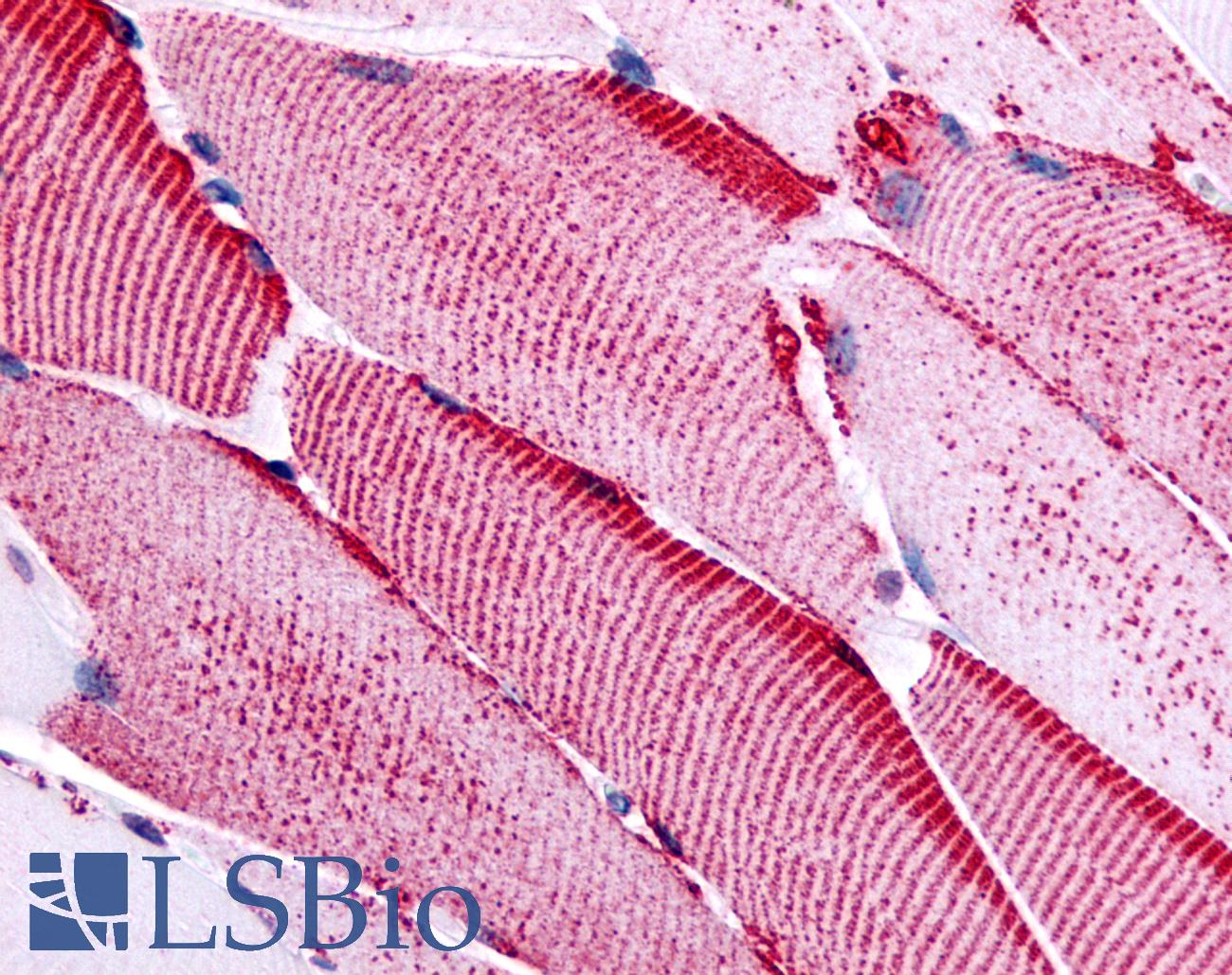 SLC5A10 / SGLT5 Antibody - Anti-SLC5A10 antibody IHC of human skeletal muscle. Immunohistochemistry of formalin-fixed, paraffin-embedded tissue after heat-induced antigen retrieval.