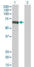 SLC5A2 / SGLT2 Antibody - Western Blot analysis of SLC5A2 expression in transfected 293T cell line by SLC5A2 monoclonal antibody (M01), clone 3G8.Lane 1: SLC5A2 transfected lysate(72.9 KDa).Lane 2: Non-transfected lysate.