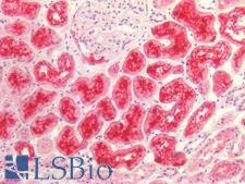 SLC5A2 / SGLT2 Antibody - Human Kidney: Formalin-Fixed, Paraffin-Embedded (FFPE)