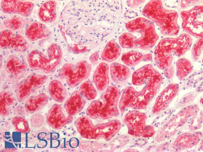 SLC5A2 / SGLT2 Antibody - Human Kidney: Formalin-Fixed, Paraffin-Embedded (FFPE)
