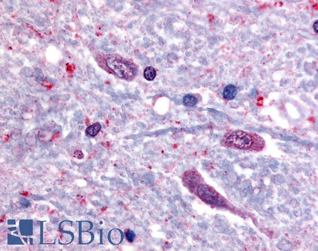 SLC5A3  Antibody - Anti-SLC5A3 antibody IHC of human spinal cord. Immunohistochemistry of formalin-fixed, paraffin-embedded tissue after heat-induced antigen retrieval.