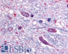 SLC5A3  Antibody - Anti-SLC5A3 antibody IHC of human spinal cord. Immunohistochemistry of formalin-fixed, paraffin-embedded tissue after heat-induced antigen retrieval.
