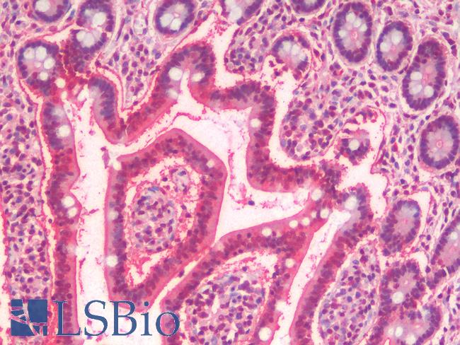 SLC5A4 / SGLT3 Antibody - Human Small Intestine: Formalin-Fixed, Paraffin-Embedded (FFPE)